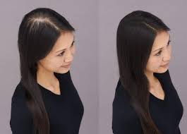 female hair fall before